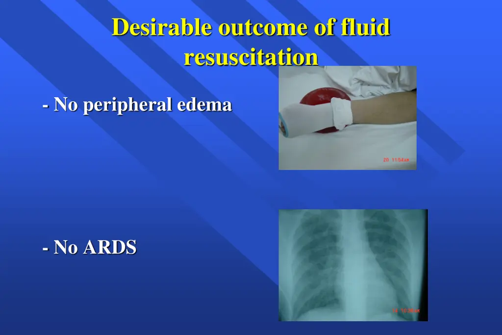 desirable outcome of fluid resuscitation