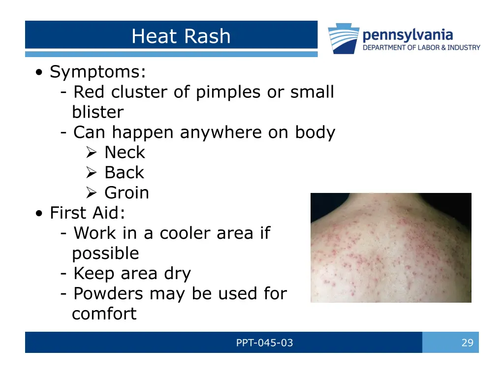 heat rash