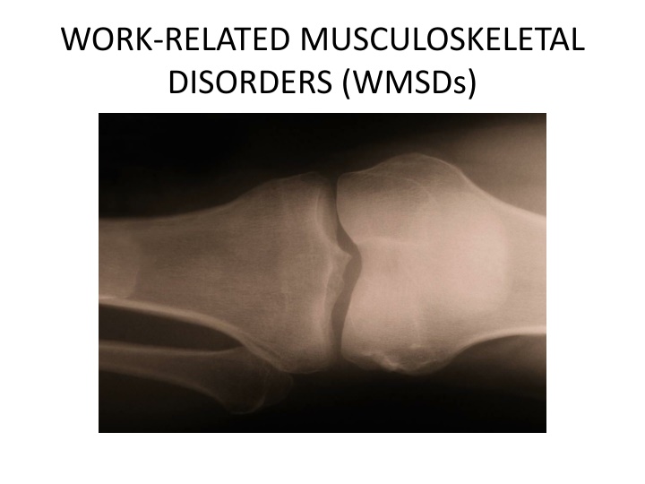 work related musculoskeletal disorders wmsds