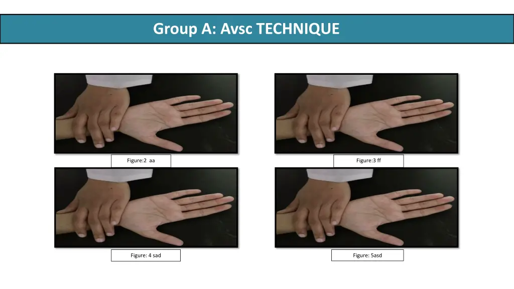 group a avsc technique