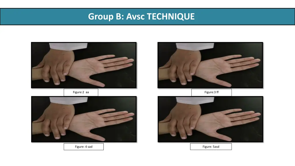 group b avsc technique