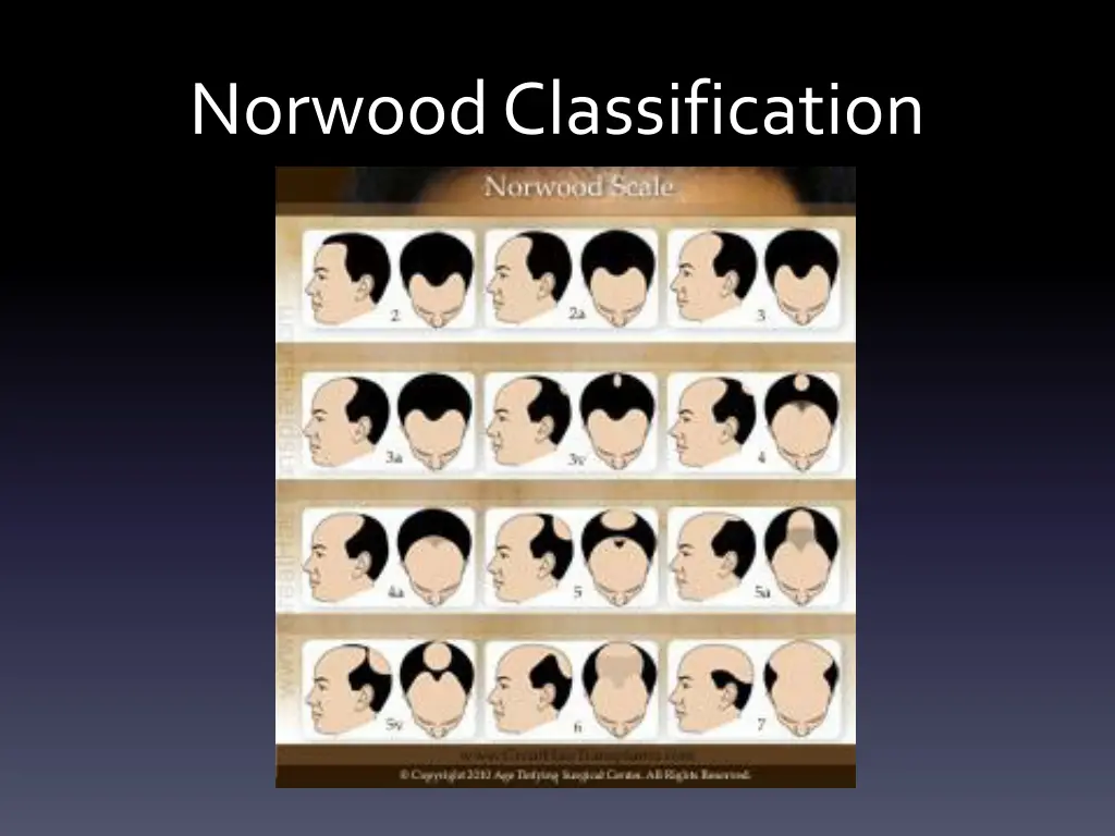 norwood classification