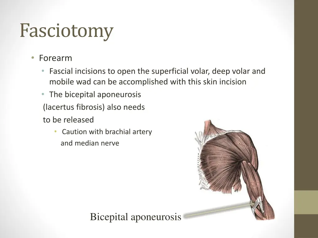 fasciotomy 5