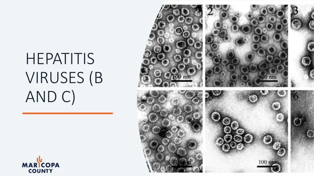 hepatitis viruses b and c