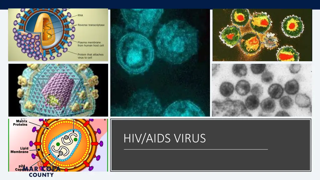 hiv aids virus