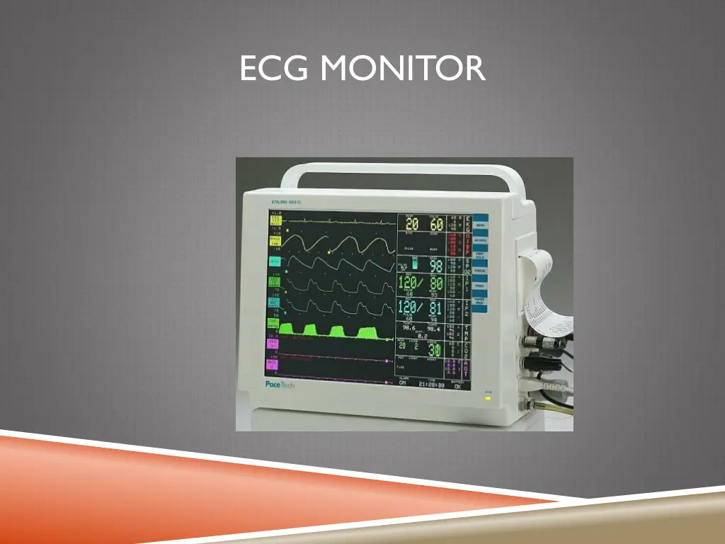 ecg monitor