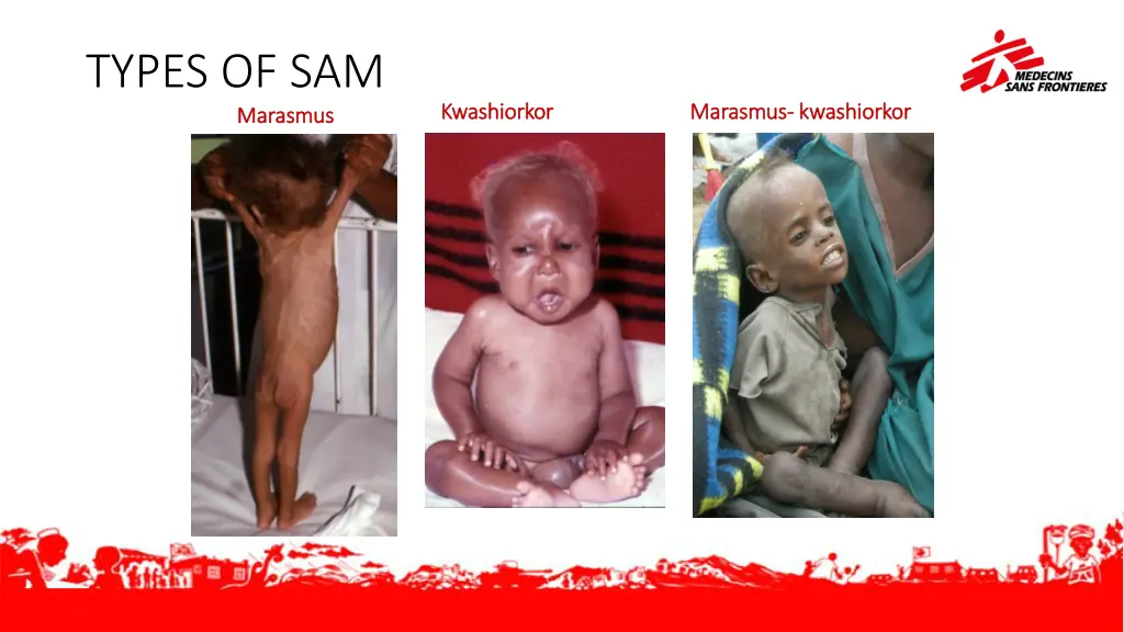 types of sam