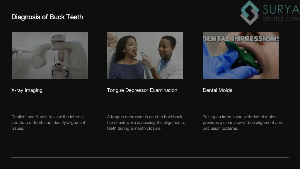 diagnosis of buck teeth diagnosis of buck teeth