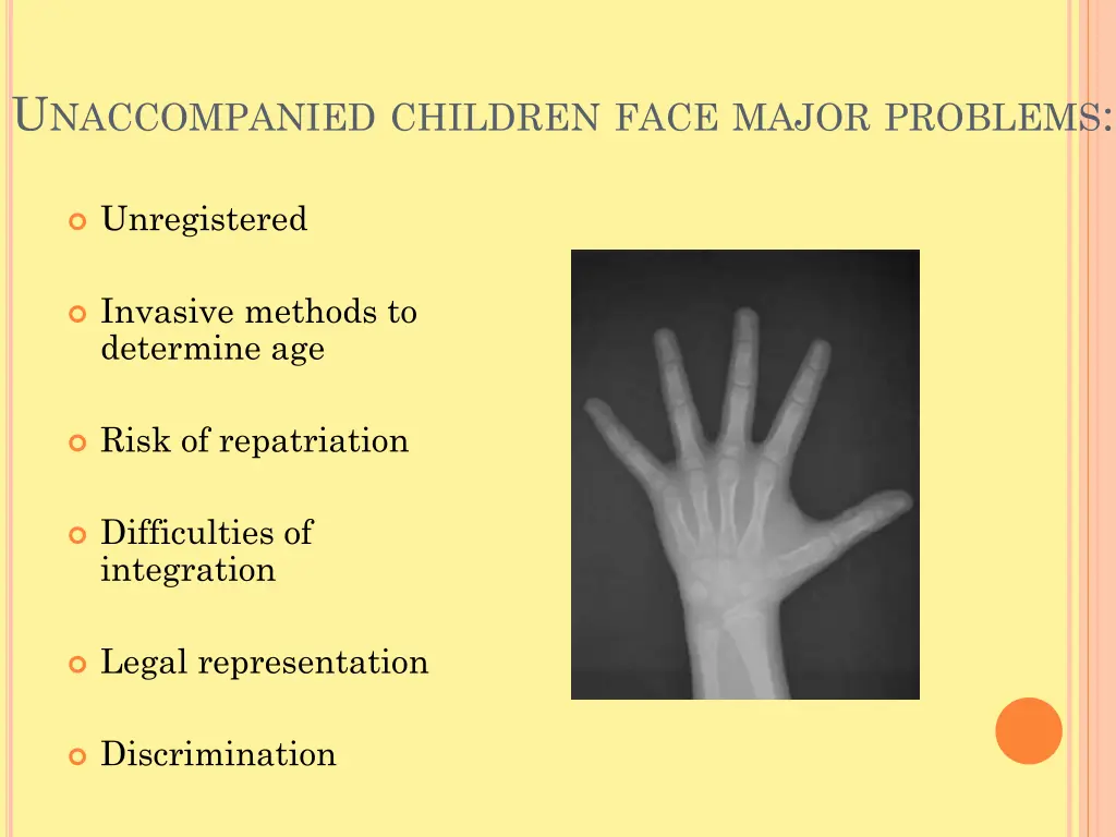 u naccompanied children face major problems