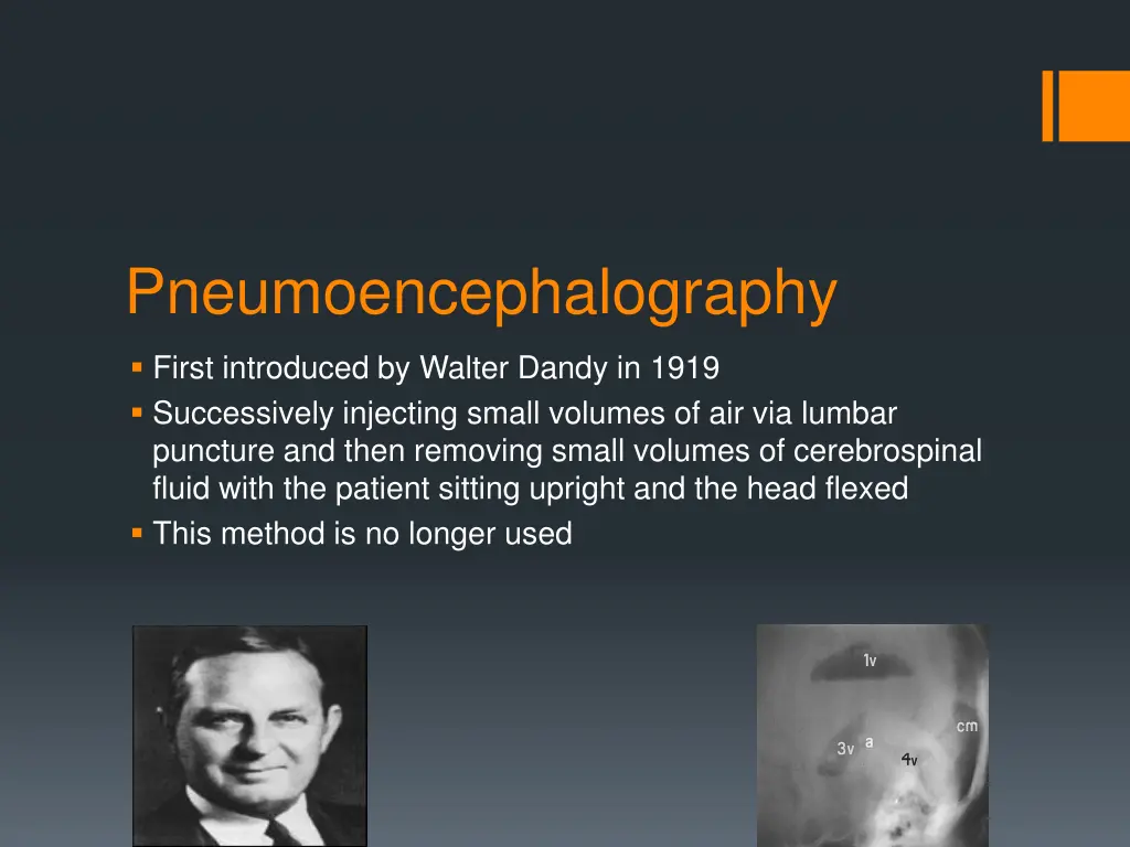 pneumoencephalography