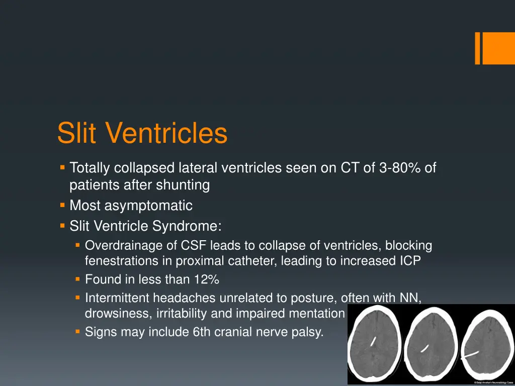 slit ventricles