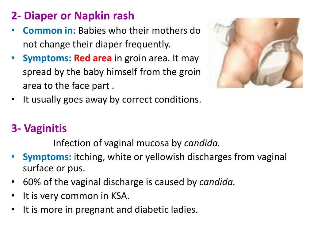 2 diaper or napkin rash common in babies