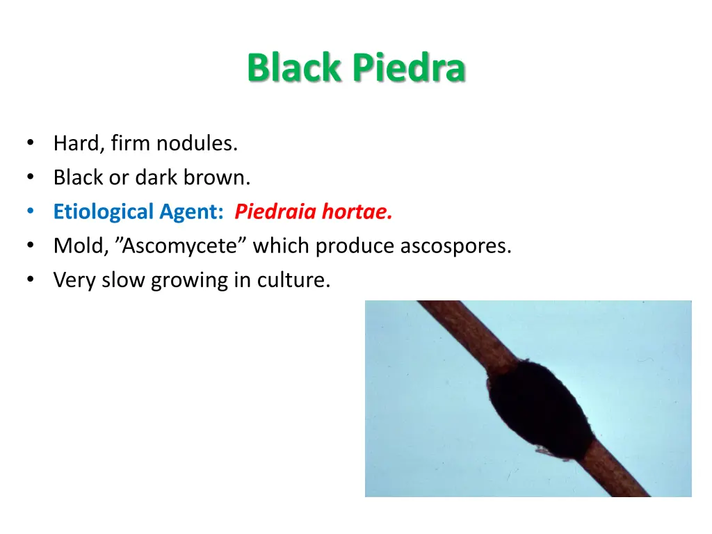 black piedra