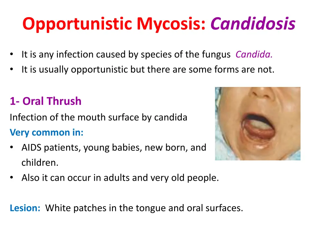 opportunistic mycosis candidosis