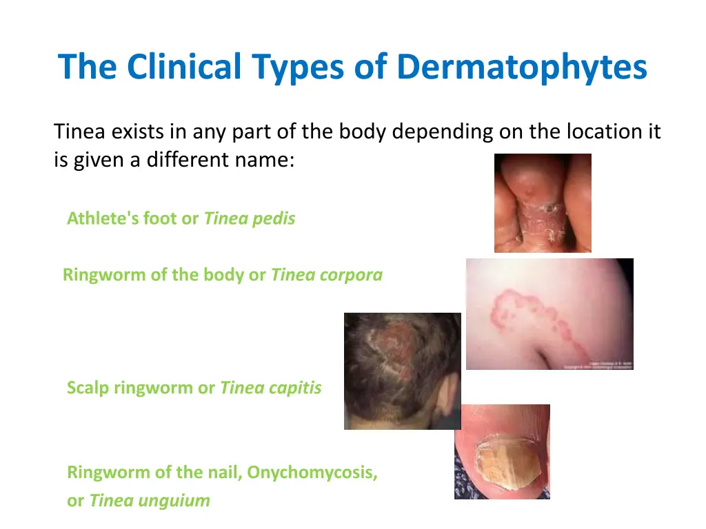 the clinical types of dermatophytes