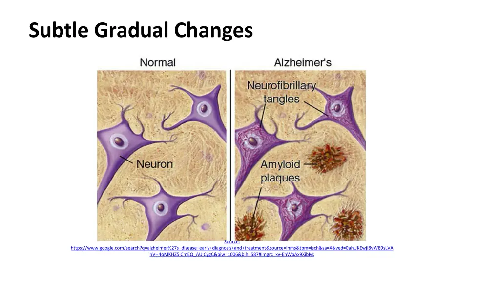 subtle gradual changes