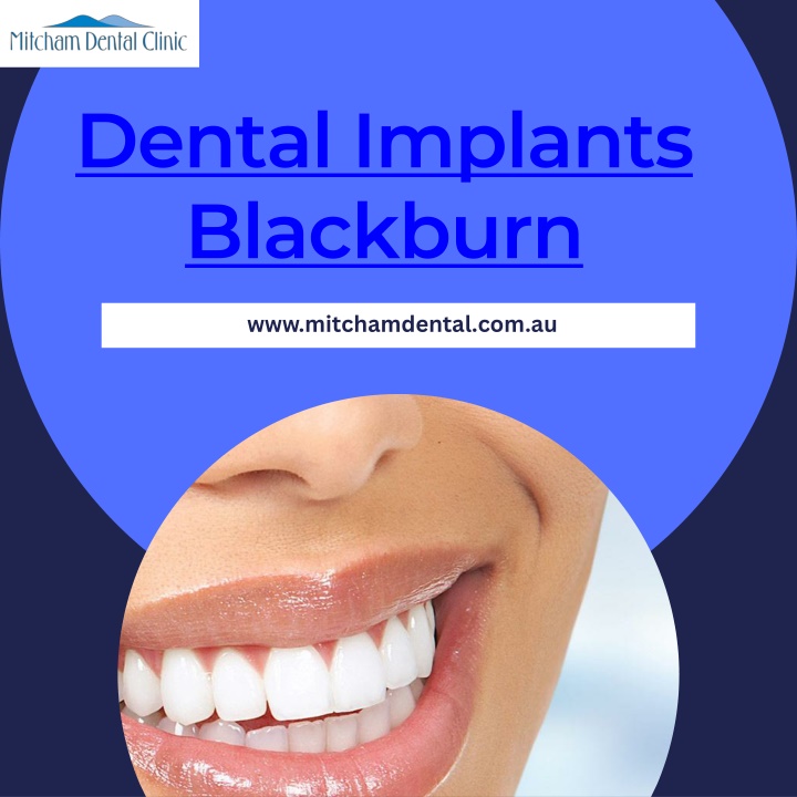 dental implants blackburn