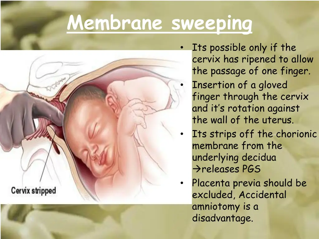 membrane sweeping