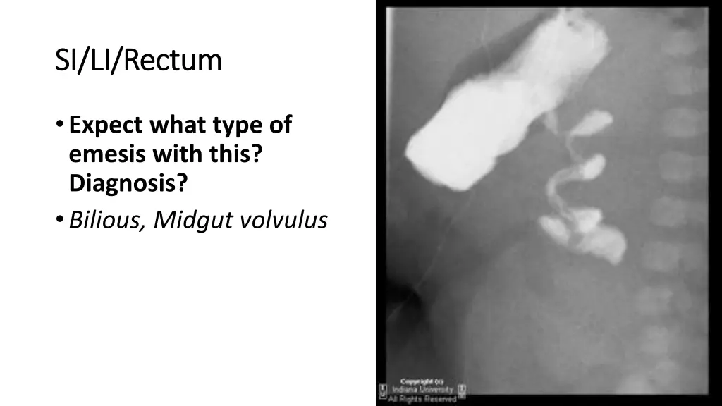 si li rectum si li rectum 3