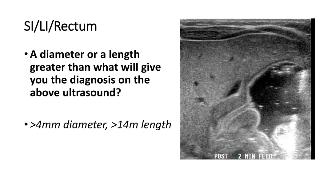 si li rectum si li rectum 4