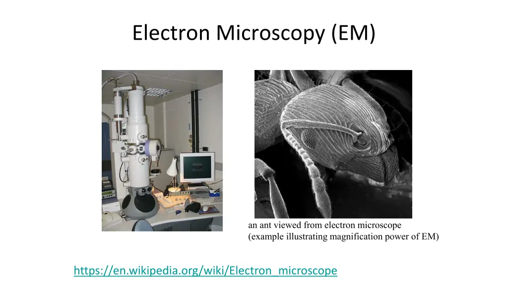 electron microscopy em