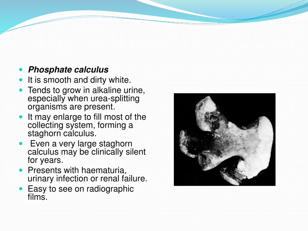 phosphate calculus it is smooth and dirty white