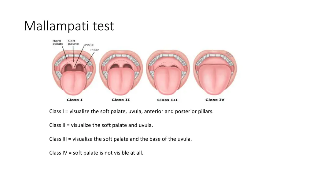 mallampati test