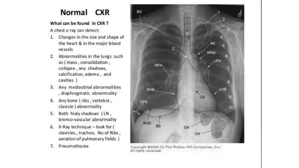 slide37