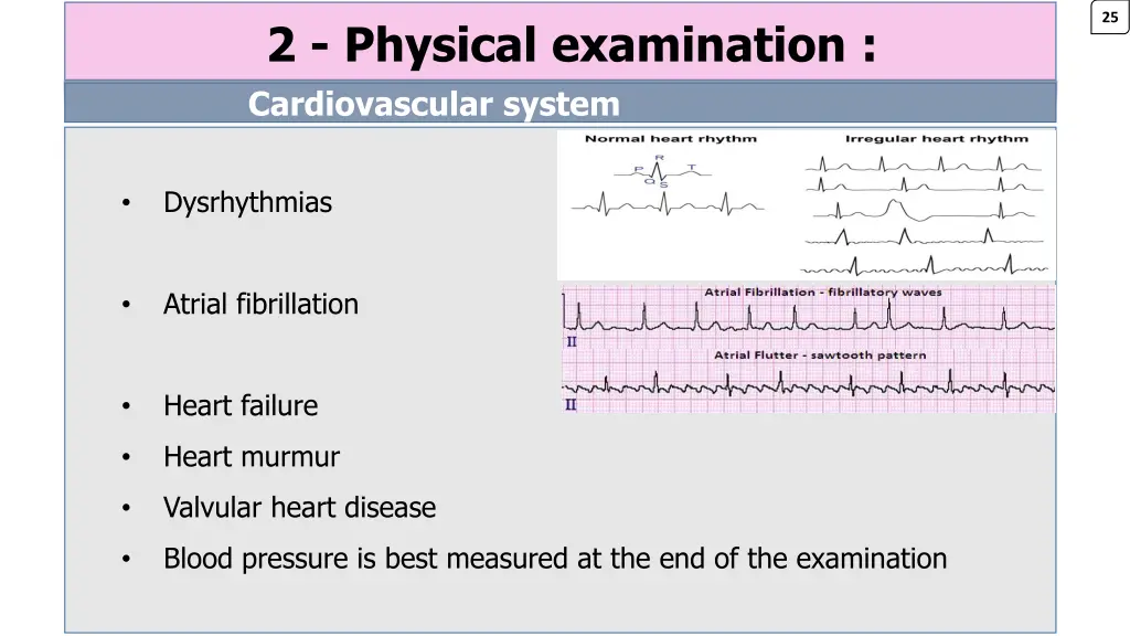 slide39