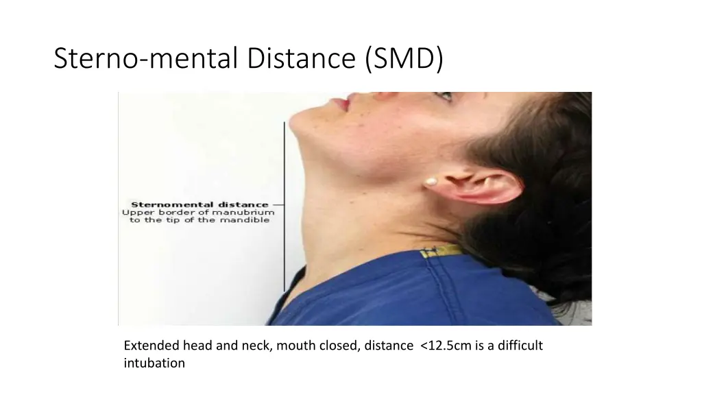 sterno mental distance smd