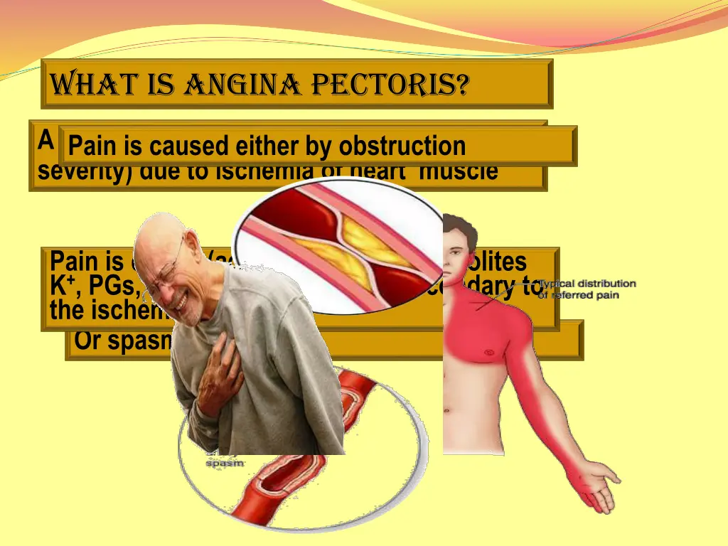 what is angina pectoris