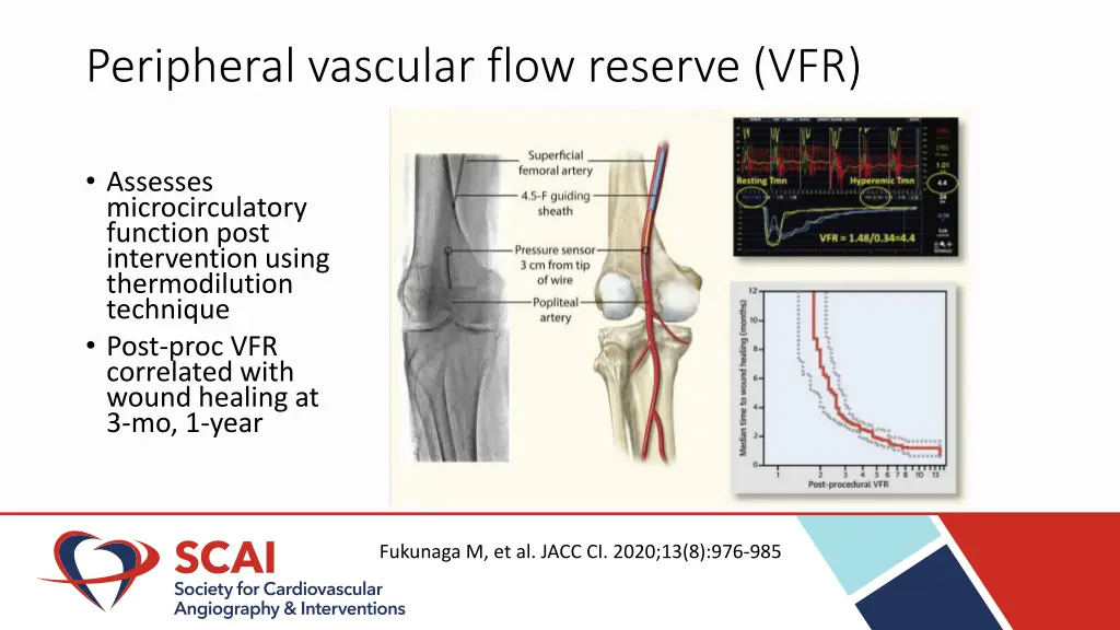 peripheral vascular flow reserve vfr