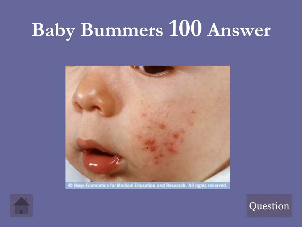 baby bummers 100 answer