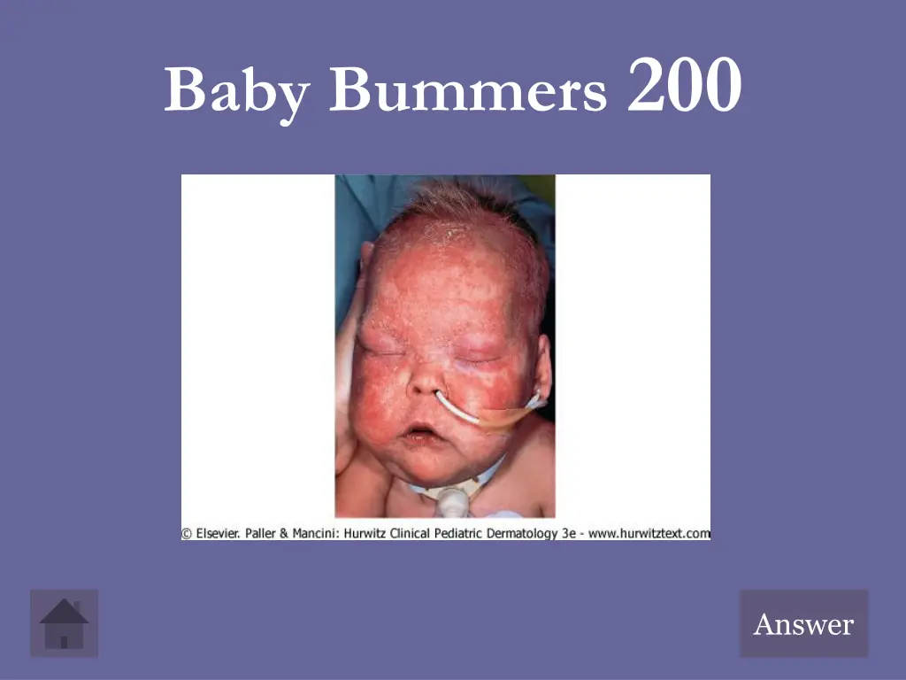 baby bummers 200