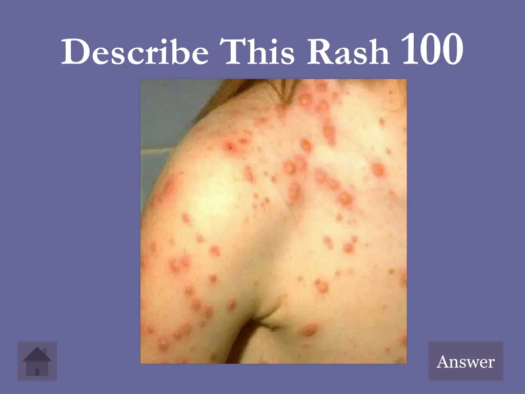 describe this rash 100