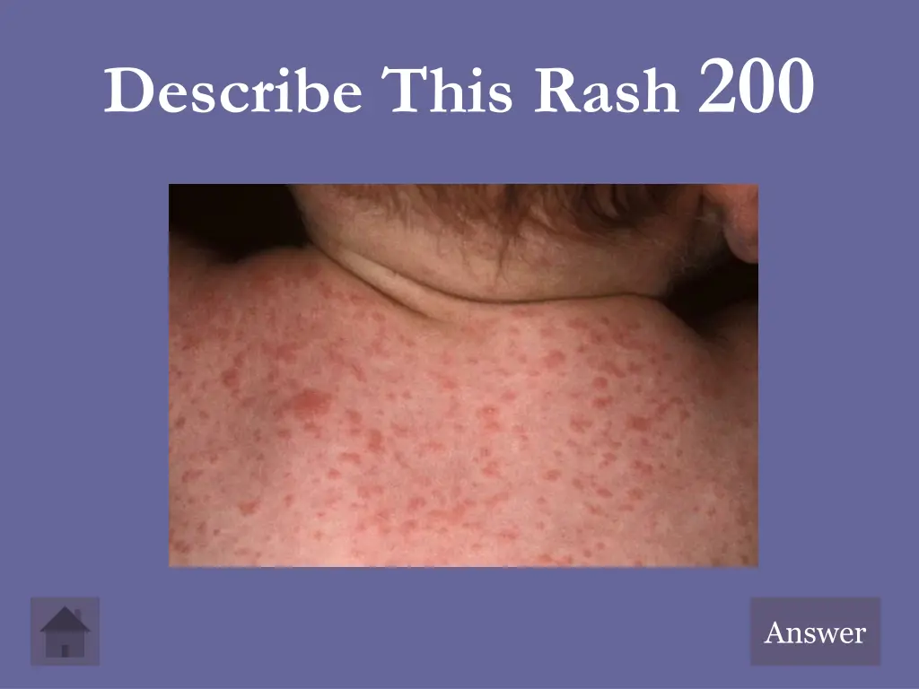 describe this rash 200