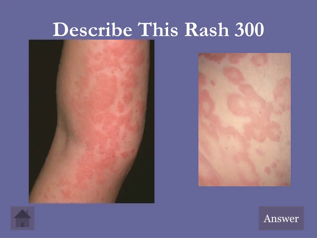 describe this rash 300