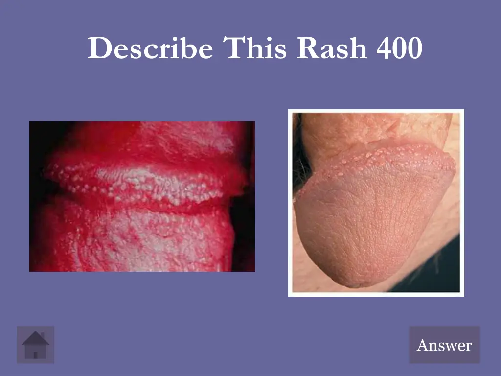 describe this rash 400