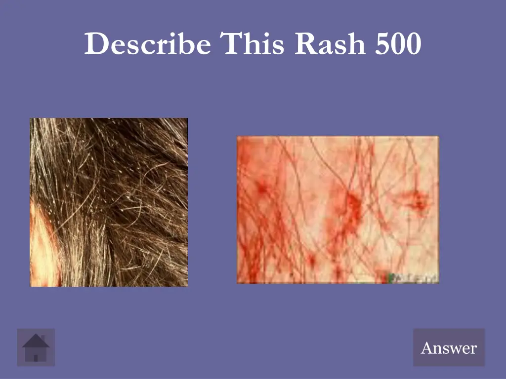 describe this rash 500