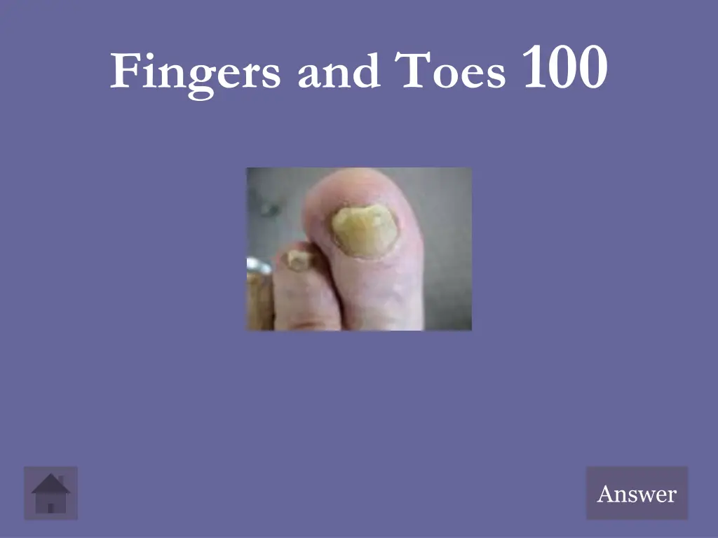 fingers and toes 100