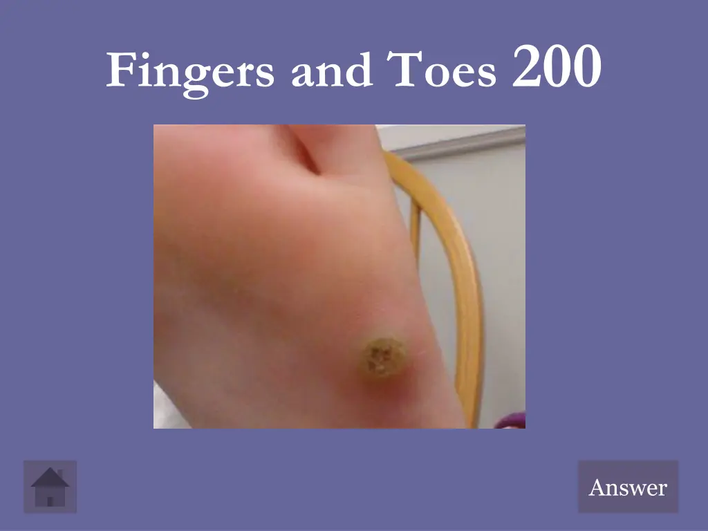 fingers and toes 200