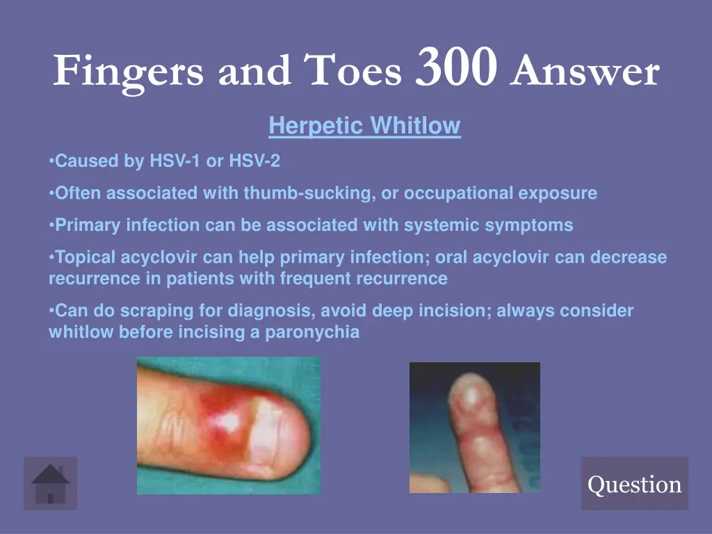 fingers and toes 300 answer herpetic whitlow