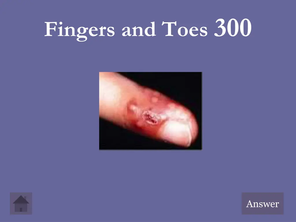 fingers and toes 300