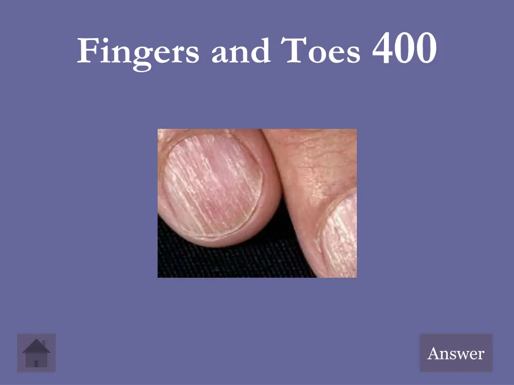 fingers and toes 400