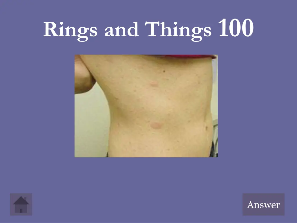 rings and things 100