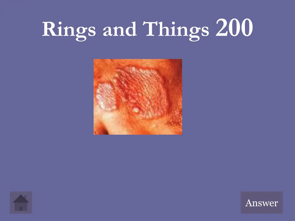 rings and things 200