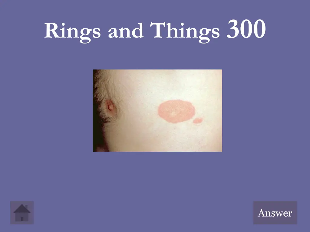 rings and things 300