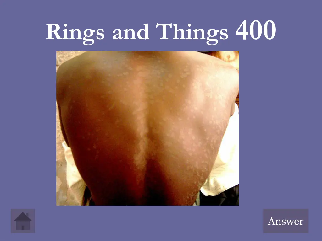 rings and things 400