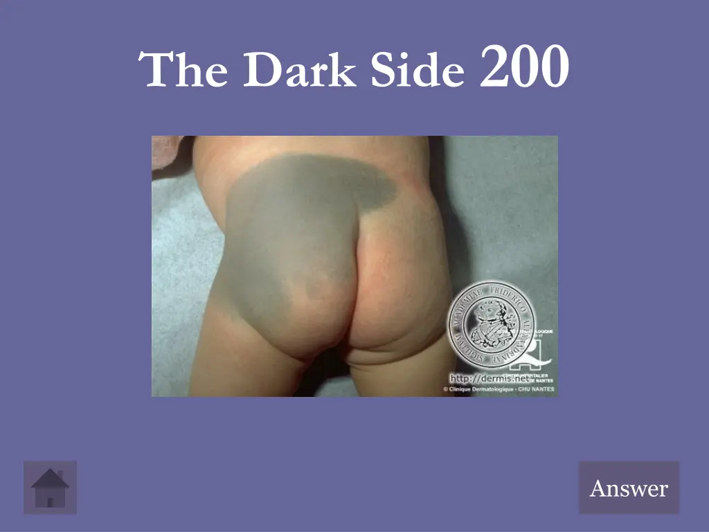 the dark side 200