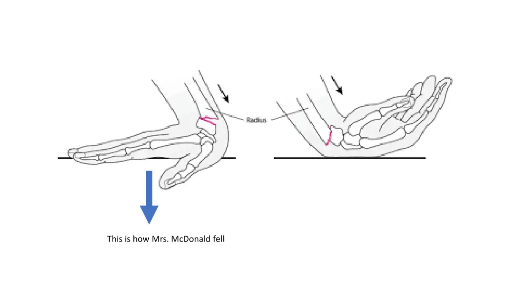 this is how mrs mcdonald fell